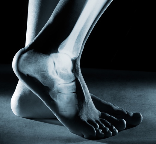 xray_foot_small
